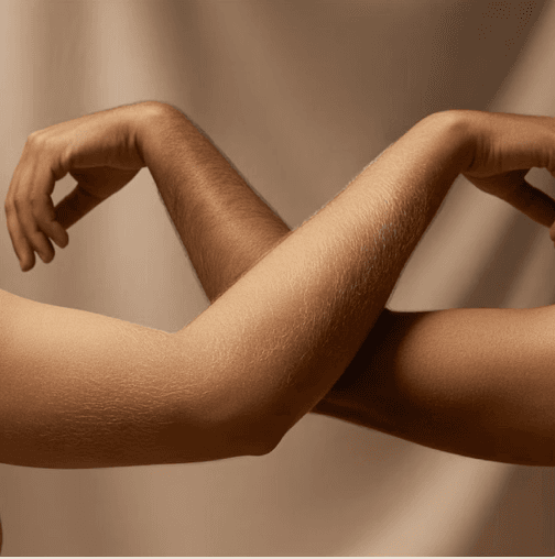 Upper arms and thighs treatment area